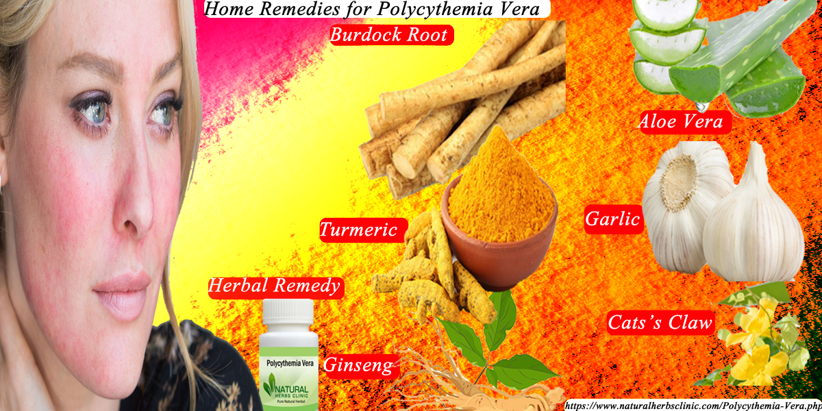 Home Remedies for Polycythemia Vera