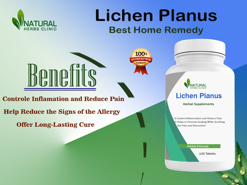 Lichen Planus Natural Treatment